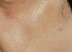 Gesichtsserum