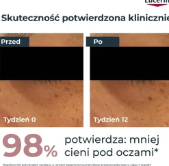 Nachtcreme gegen Pigmentflecken
