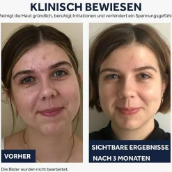 Reinigungstoner mit Präbiotika und Postbiotika