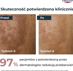 Tagescreme gegen Pigmentflecken SPF 30
