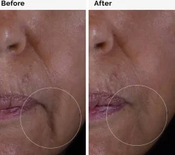 The Ordinary GF Solution 15% Serum